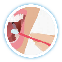 mẫu niêm mạc miệng